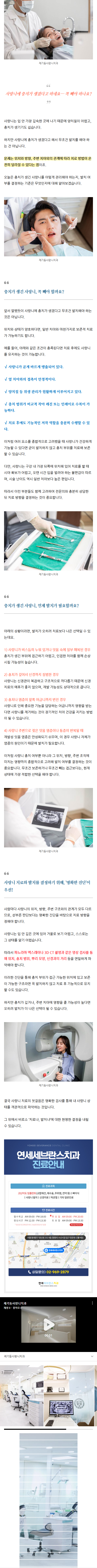 회기역임플란트 rrzbo