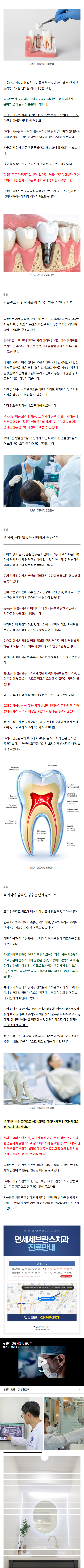 제기동턱관절 ucwlc